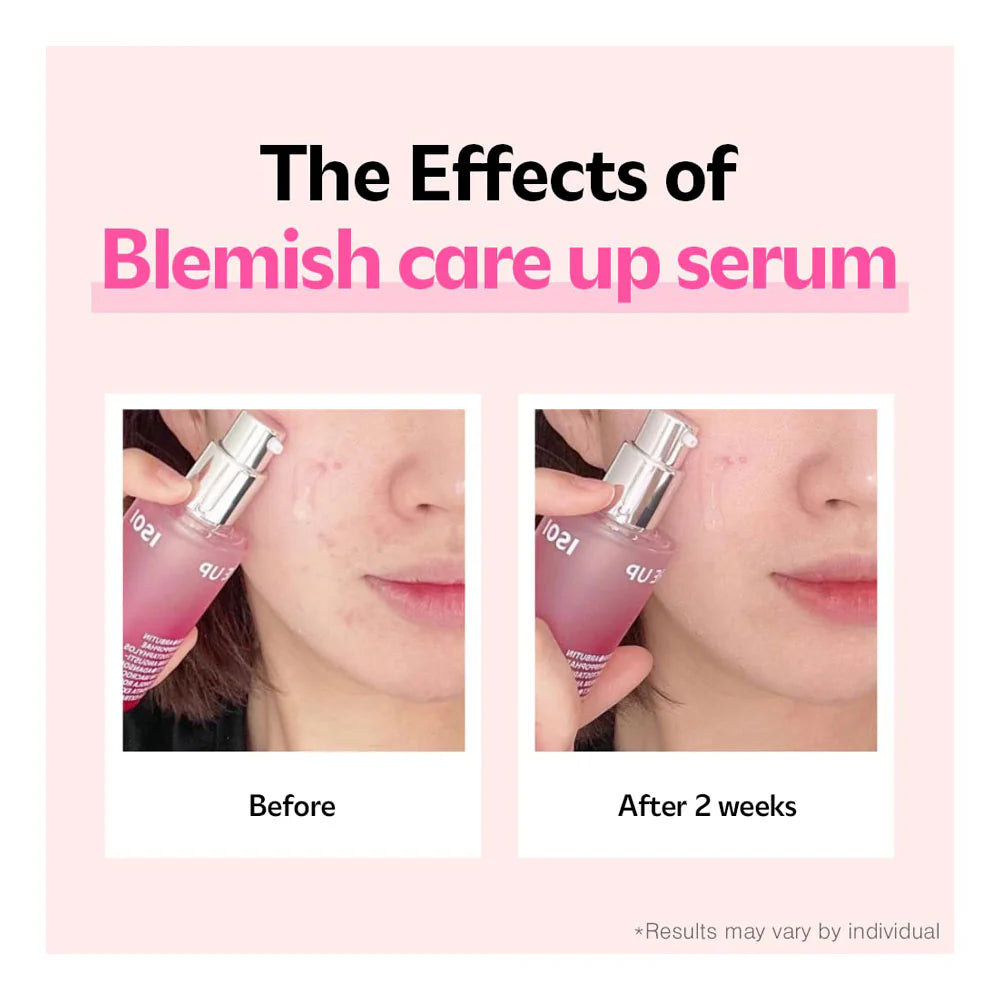 ISOI Blemish Care Up Serum Edición Especial 1+1